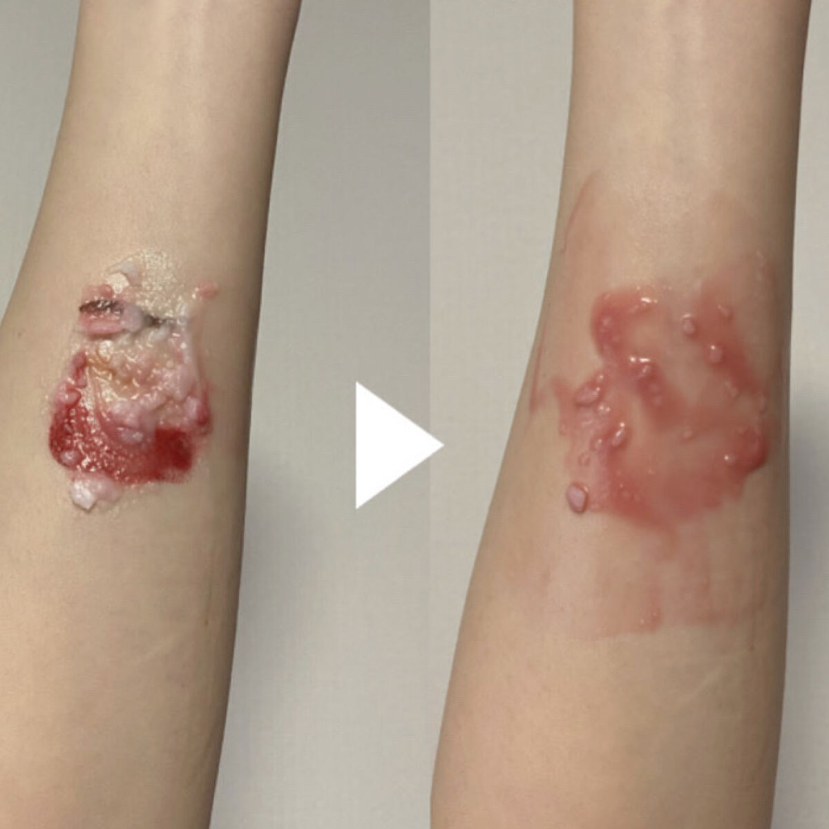 デュオ ザ クレンジングバーム/DUO/クレンジングバームを使ったクチコミ（2枚目）