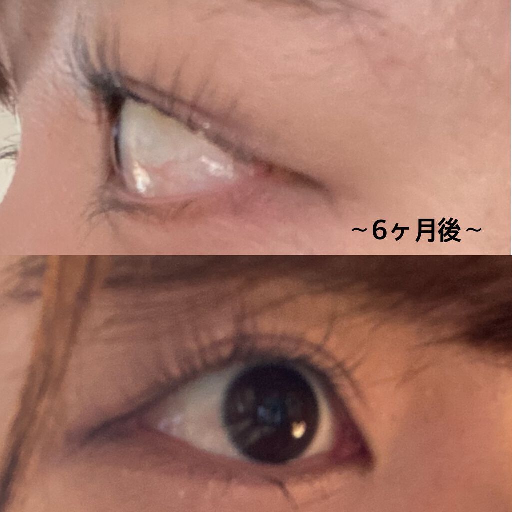 ラッシュアディクト アイラッシュコンディショニングセラム/soaddicted/まつげ美容液を使ったクチコミ（3枚目）