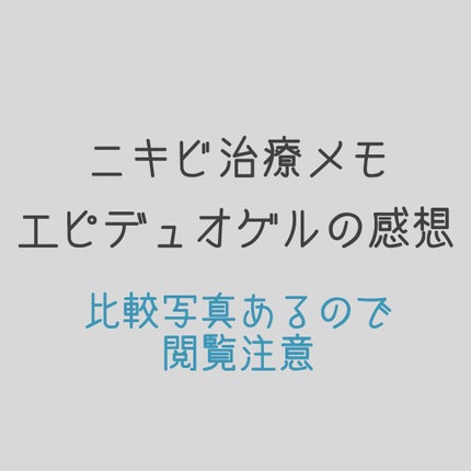 さいきa 保水治療ローション(医薬品)/Saiki/その他を使ったクチコミ(1枚目)