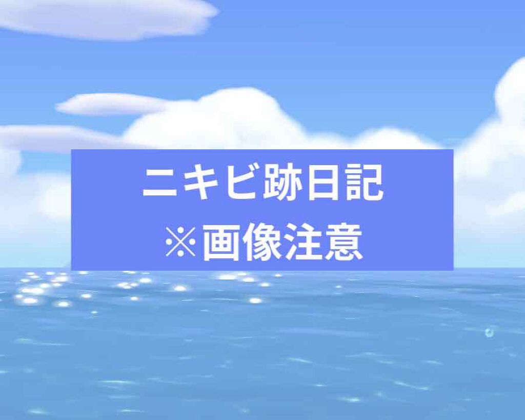 ペアアクネクリームW(医薬品)/ペア/その他を使ったクチコミ（1枚目）