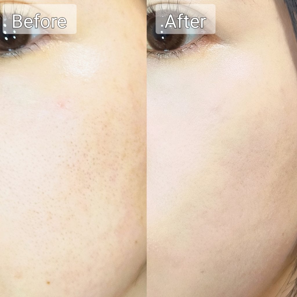 ピンクティーツリーカバーアップグロウクッション/APLIN/クッションファンデーションを使ったクチコミ(5枚目)