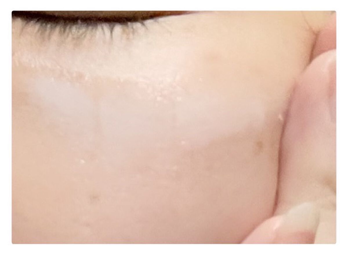 モイスチュア クリーム/カルテHD/フェイスクリームを使ったクチコミ(4枚目)