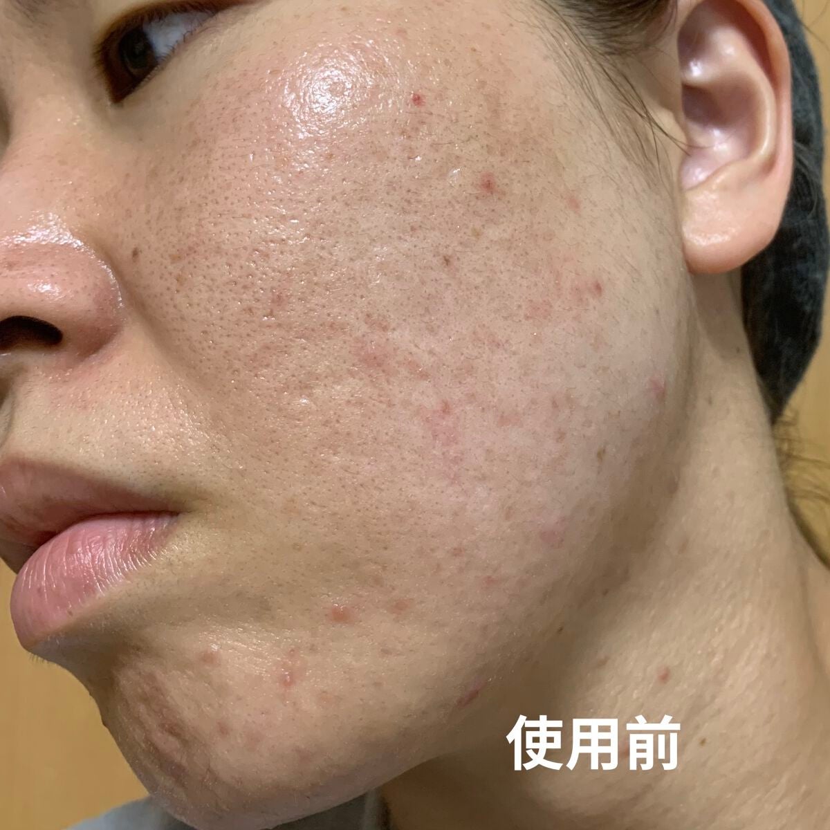 モイスチャーバランスローション/PHOEBE BEAUTY UP/化粧水を使ったクチコミ(2枚目)