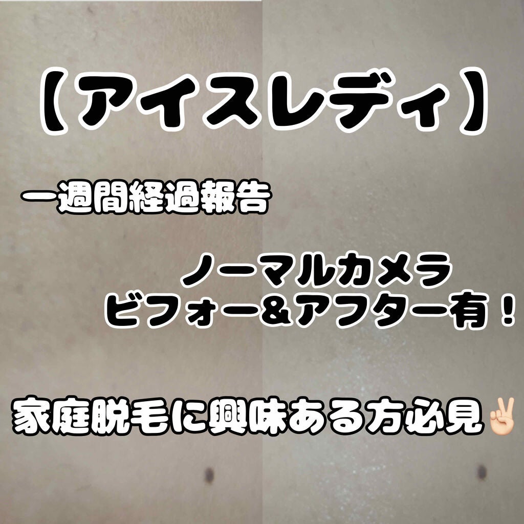 ハトムギ化粧水(ナチュリエ スキンコンディショナー R )/ナチュリエ/化粧水を使ったクチコミ(1枚目)