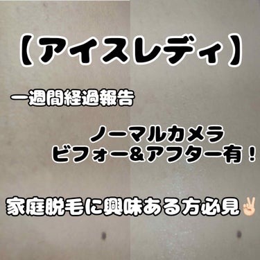 こんにちは、　せあ丸　です😊
アイスレディを使い始めて一週間、気になった事等の報告をしたいと思います✌🏻

質問などもウェルカムです！むしろしてください(？)

♡┈┈┈┈┈┈┈┈┈┈┈┈┈┈┈♡

❤