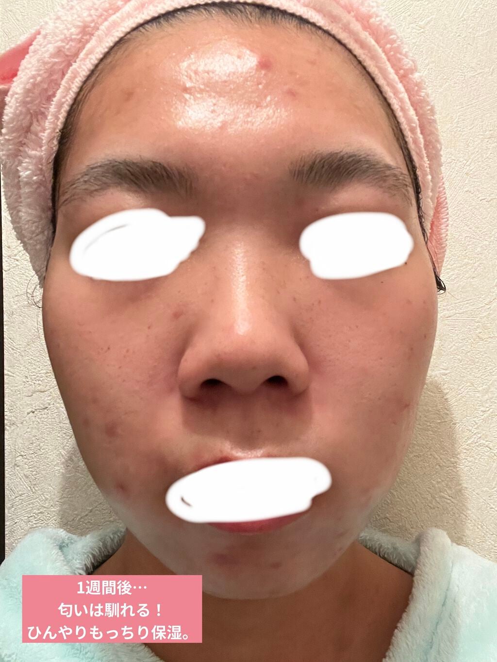 CICA ãã€ãªãŒã¹ãŒãžã³ã°ãã¹ã¯/VT/ã·ãŒããã¹ã¯ã»ããã¯ã䜿ã£ãã¯ãã³ãïŒ5æç®ïŒ