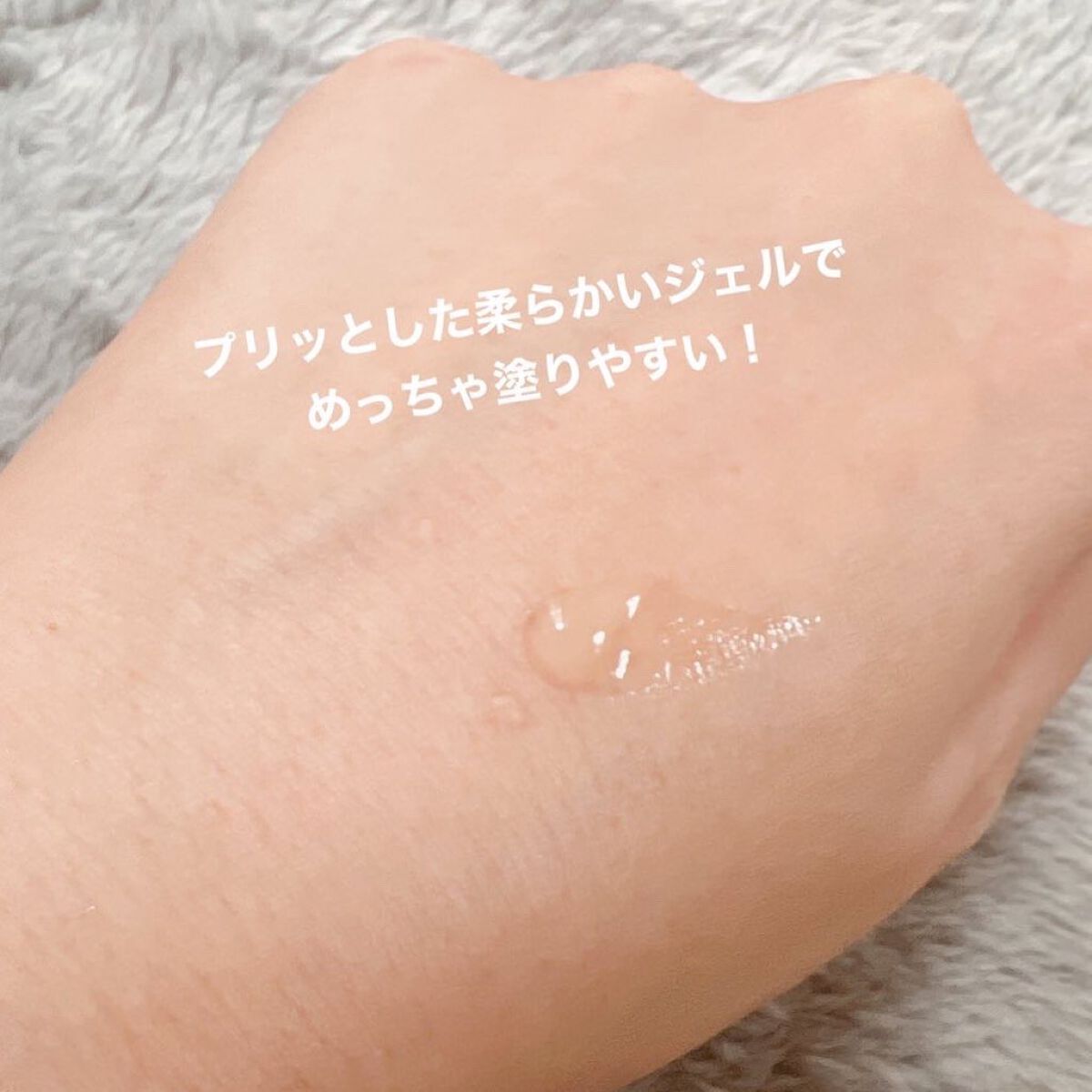 ニキビあとケアジェル/アットノン/その他スキンケアを使ったクチコミ(3枚目)