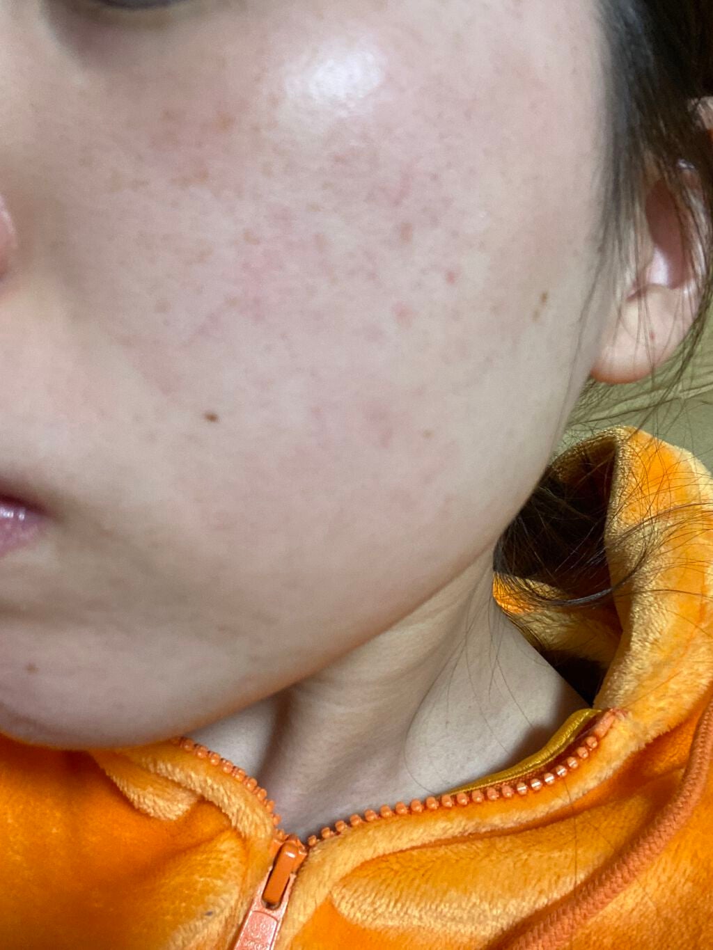 トラブルリペア リキッド/アルージェ/美容液を使ったクチコミ(4枚目)