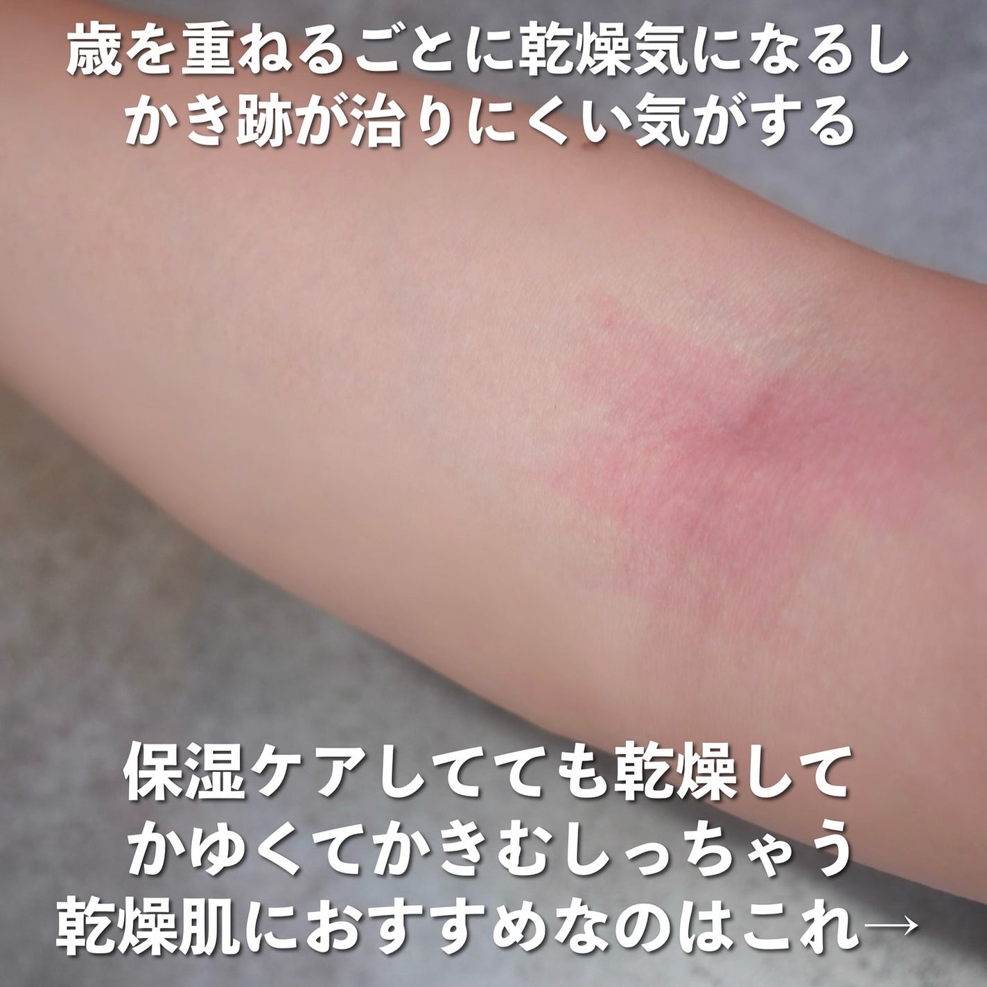 ヘパソフトプラス(医薬品)/ロート製薬/その他を使ったクチコミ(2枚目)