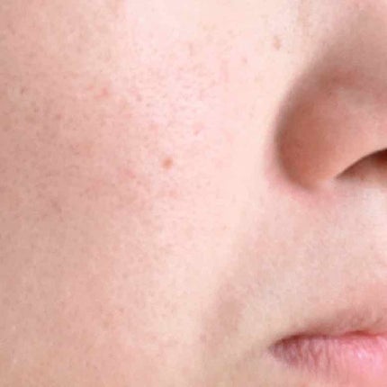 薬用クリアマスクP(美白ピーリングジェル)/DAISO/ピーリングを使ったクチコミ(4枚目)