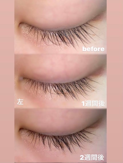 アイラッシュセラム/THE STEM CELL/まつげ美容液を使ったクチコミ(4枚目)