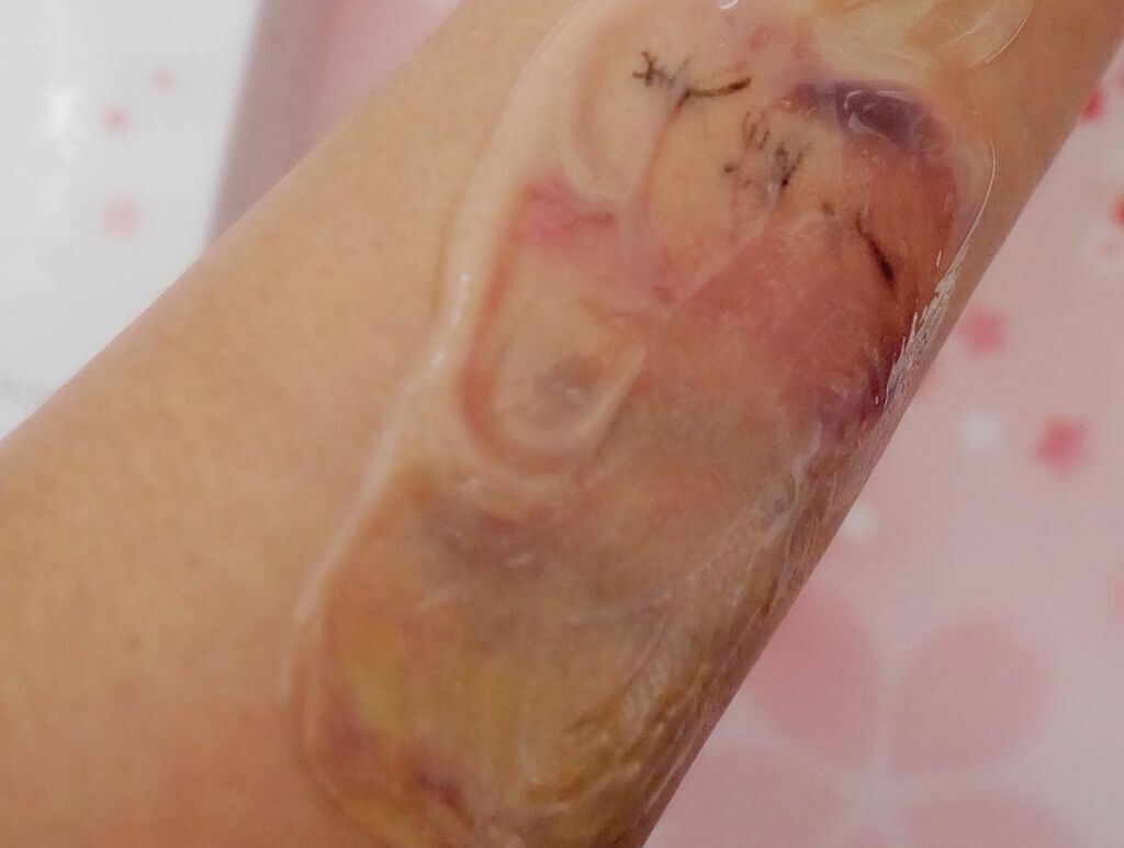 ひだまり@毎日投稿✨ on LIPS 「.本来の美しい肌に導く 新感覚クレンジング//..美温令ホット..」(4枚目)