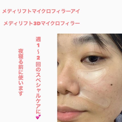 メディリフト 3Dマイクロフィラー(口元用)/YA-MAN TOKYO JAPAN/シートマスク・パックを使ったクチコミ(5枚目)