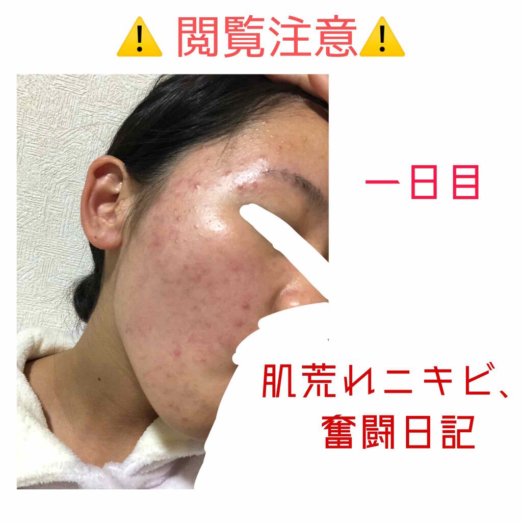 化粧水・敏感肌用・高保湿タイプ/無印良品/化粧水を使ったクチコミ（1枚目）