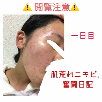 化粧水・敏感肌用・高保湿タイプ/無印良品/化粧水を使ったクチコミ(1枚目)