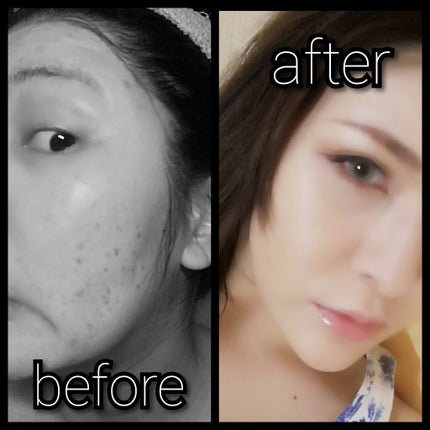 トランスペアレントフィニッシュパウダー/キャンメイク/プレストパウダーを使ったクチコミ(1枚目)