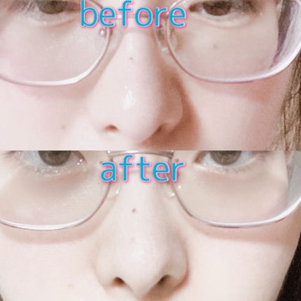 毛穴小町 イエローピールオフパック/クリアターン/ピーリングを使ったクチコミ(6枚目)