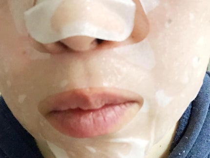 モイストリッチマスク/chione/シートマスク・パックを使ったクチコミ(5枚目)