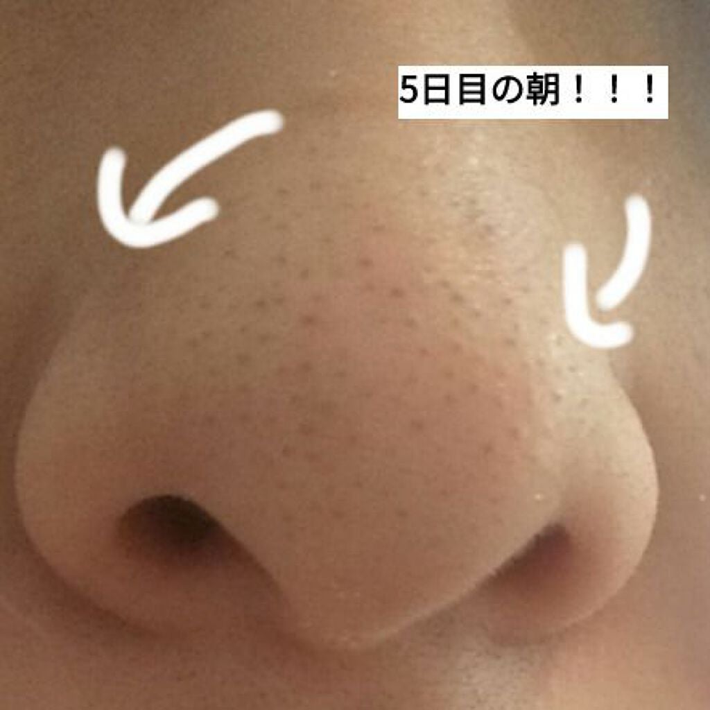 ホホバオイル/無印良品/ボディオイルを使ったクチコミ(1枚目)