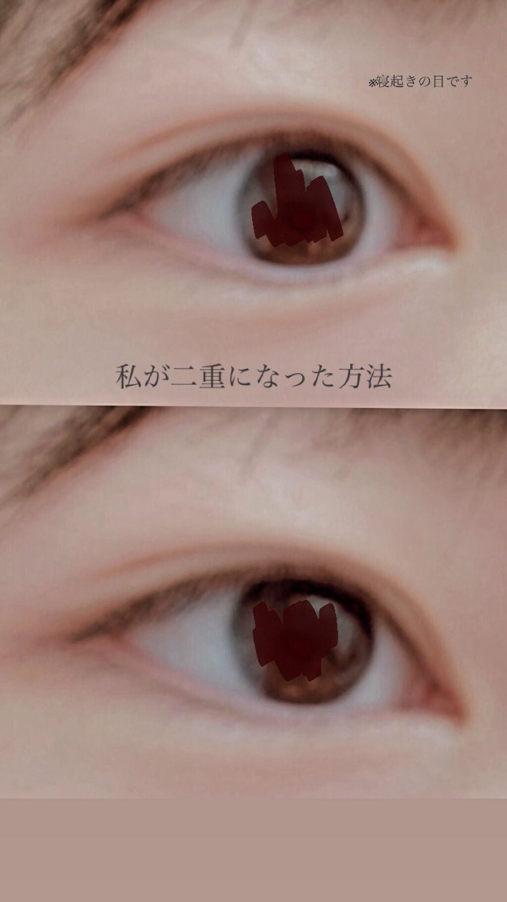 のびーるアイテープ(絆創膏タイプ、レギュラー)/DAISO/二重まぶた用アイテムを使ったクチコミ(1枚目)