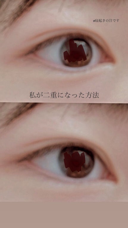 のびーるアイテープ(絆創膏タイプ、レギュラー)/DAISO/二重まぶた用アイテムを使ったクチコミ(1枚目)