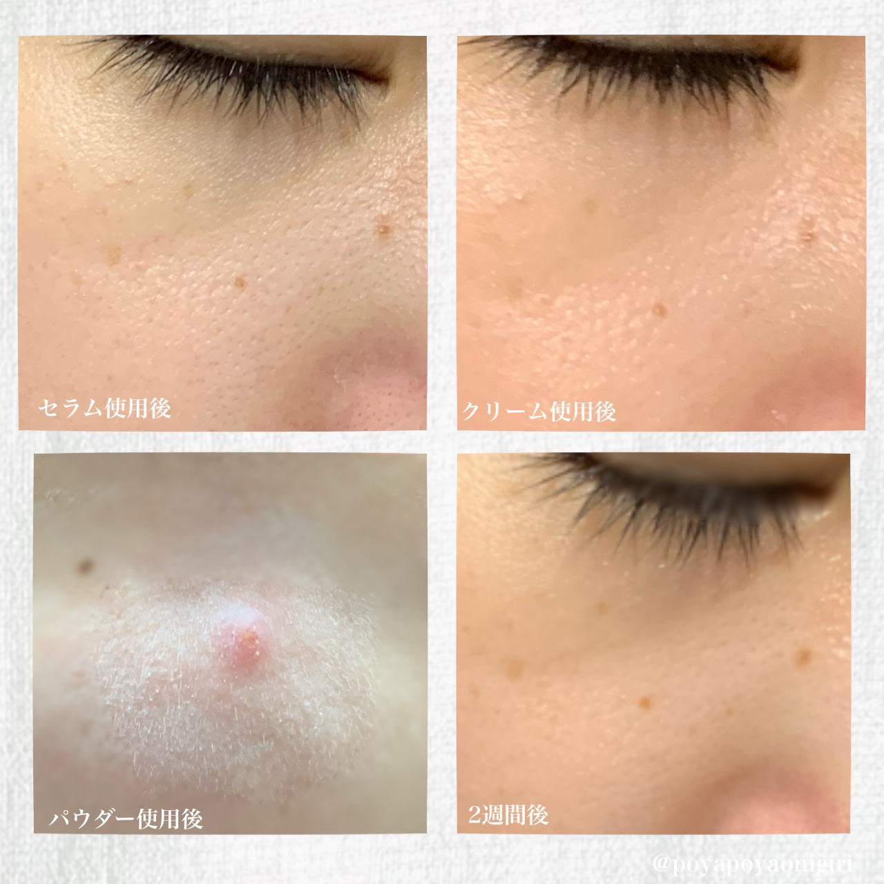 1番 塗るパントテン酸スージングクリーム/numbuzin/フェイスクリームを使ったクチコミ（2枚目）