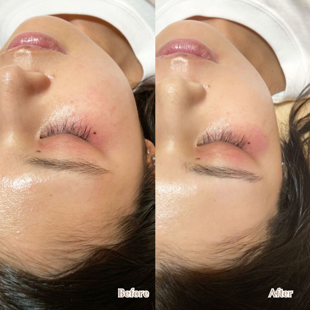 ラッシュアディクト アイラッシュコンディショニングセラム/soaddicted/まつげ美容液を使ったクチコミ（1枚目）