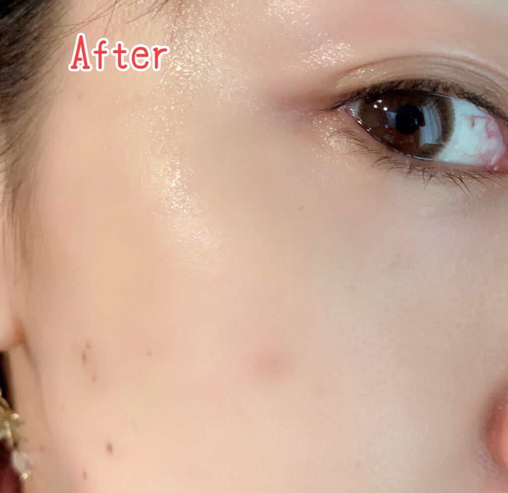 リッチローション/YELLFOR/化粧水を使ったクチコミ(8枚目)