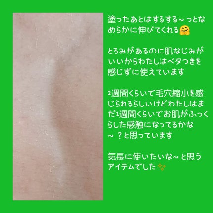 毛穴アンプル/ブラン/美容液を使ったクチコミ(3枚目)
