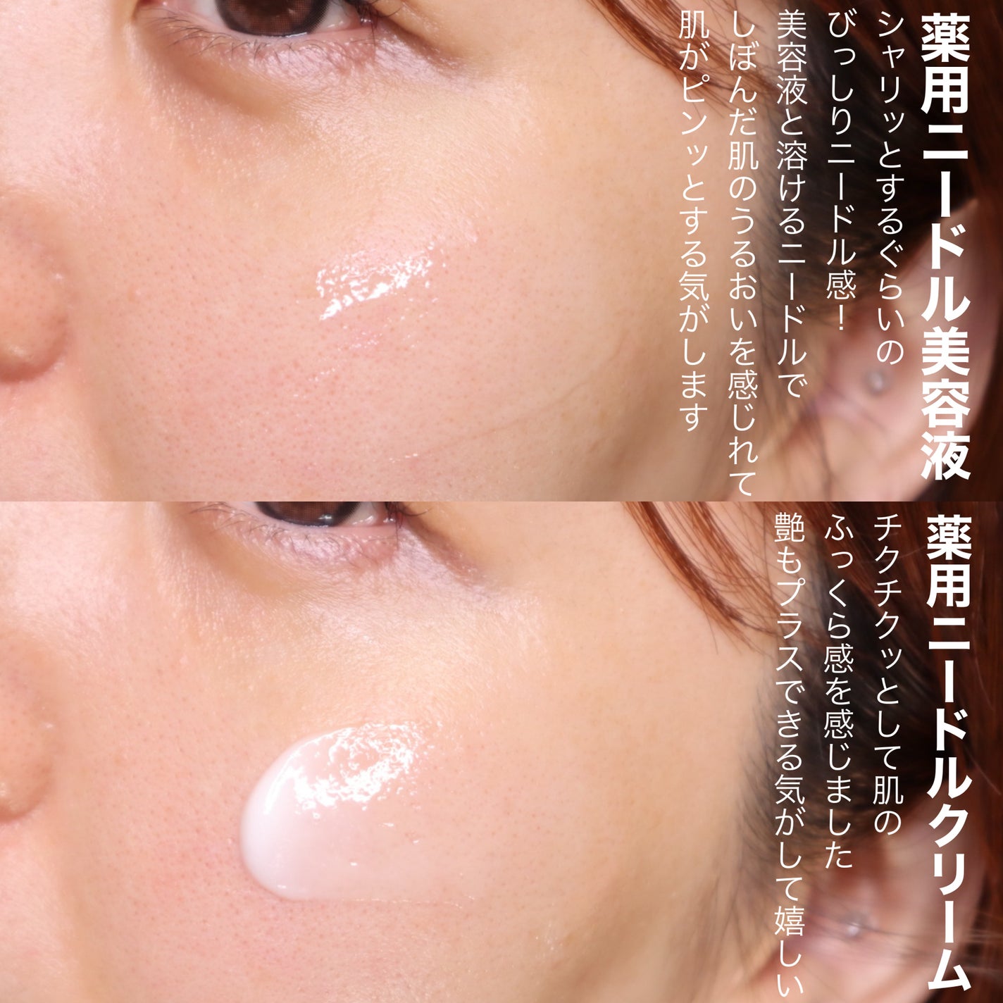 京薬粧 薬用ニードル美容液/京薬粧/美容液を使ったクチコミ(8枚目)