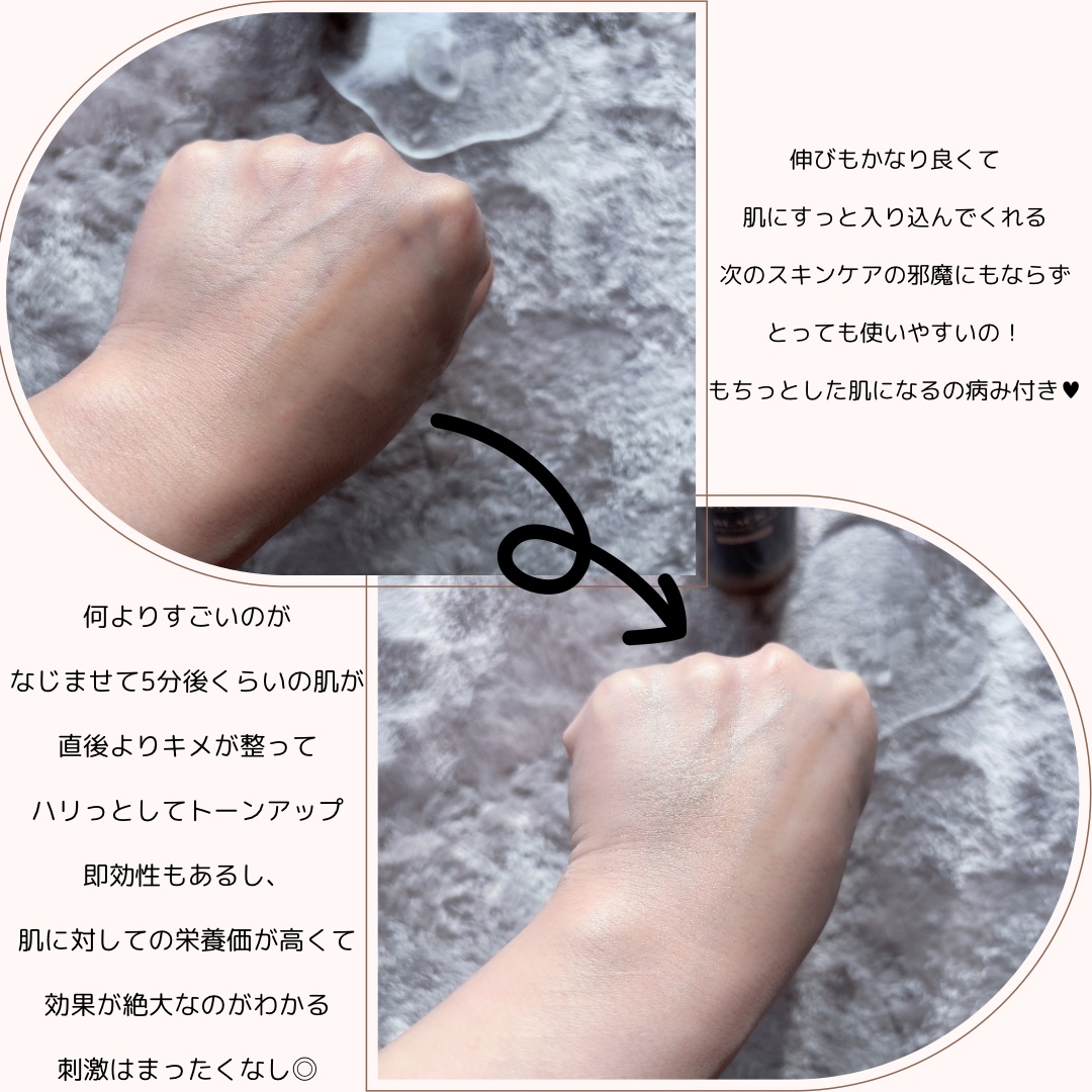 ブラックスネイルレチノールセラム/Dr.G/美容液を使ったクチコミ（3枚目）