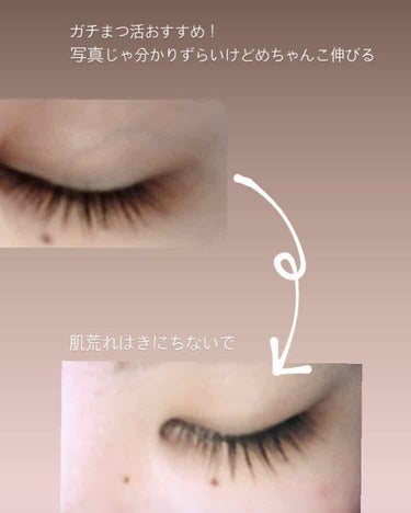 FEG  Eyelash  Enhancer/FEG/まつげ美容液を使ったクチコミ（1枚目）