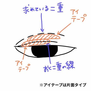 ふたえテープ 目立たず肌になじむ絆創膏タイプ/DAISO/二重まぶた用アイテムを使ったクチコミ（2枚目）