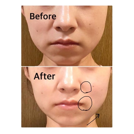 イオン導入美顔器フォトマックス /ar&ar /美顔器・マッサージを使ったクチコミ(5枚目)