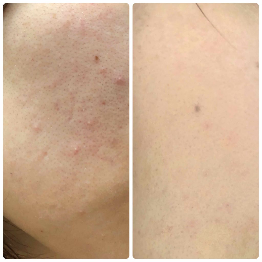 クリエイティブコンシーラーe/IPSA/パレットコンシーラーを使ったクチコミ（3枚目）