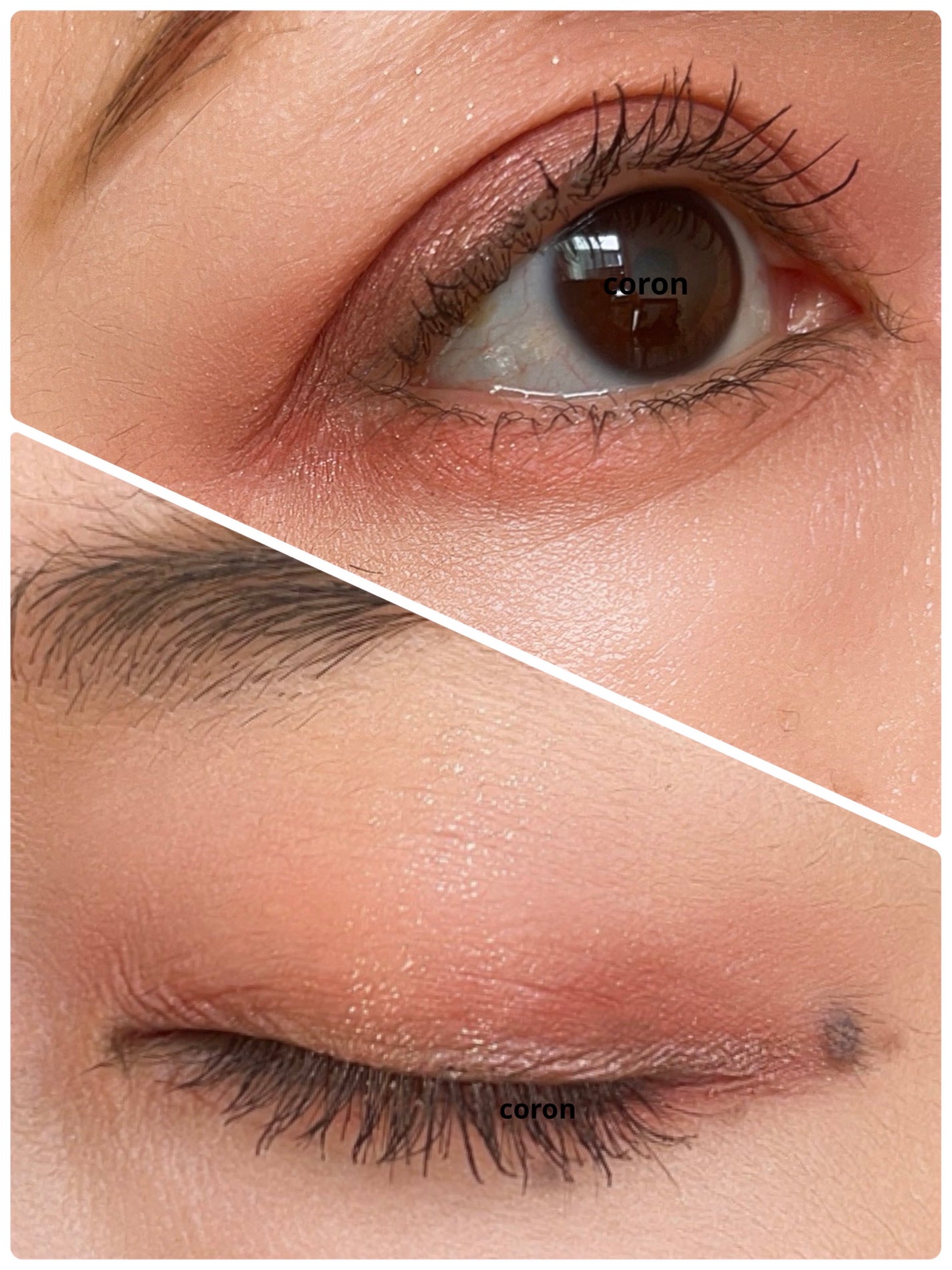 ã°ãªãã¿ãŒã¬ã€ã€ãªã³ã°ã¢ã€ã·ã£ããŠãã¬ãã/TWINKLE POP/ã¢ã€ã·ã£ããŠãã¬ããã䜿ã£ãã¯ãã³ãïŒ2æç®ïŒ