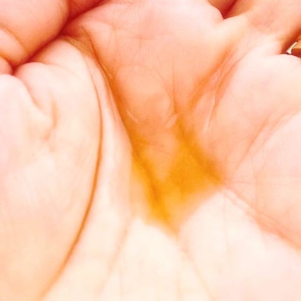 Skinable Essence/komame/美容液を使ったクチコミ(4枚目)