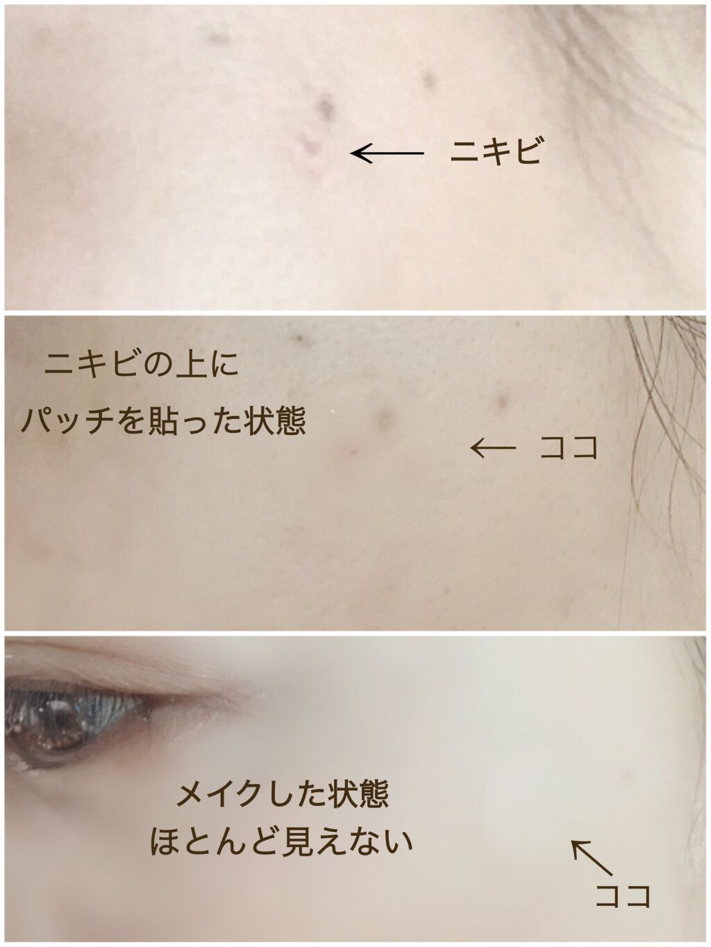 エラバンドパッチ/ElaBAND/その他を使ったクチコミ(2枚目)