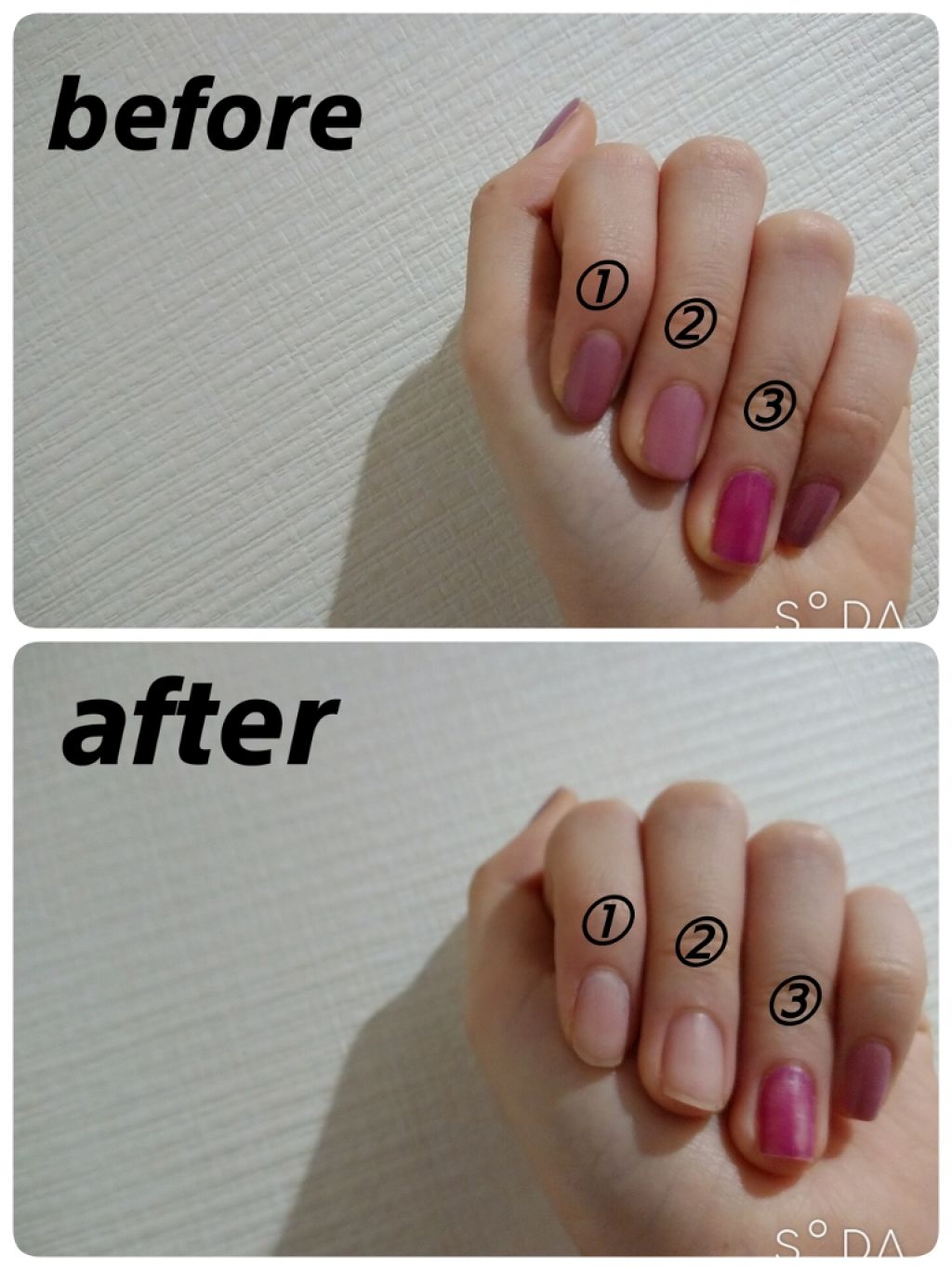 ノンアセトンリムーバー/ネイリスト/除光液を使ったクチコミ（3枚目）