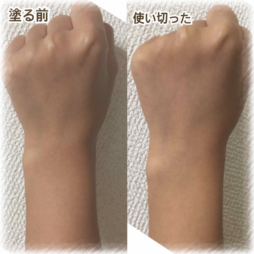 薬用美白 美容液/DAISO/美容液を使ったクチコミ（2枚目）