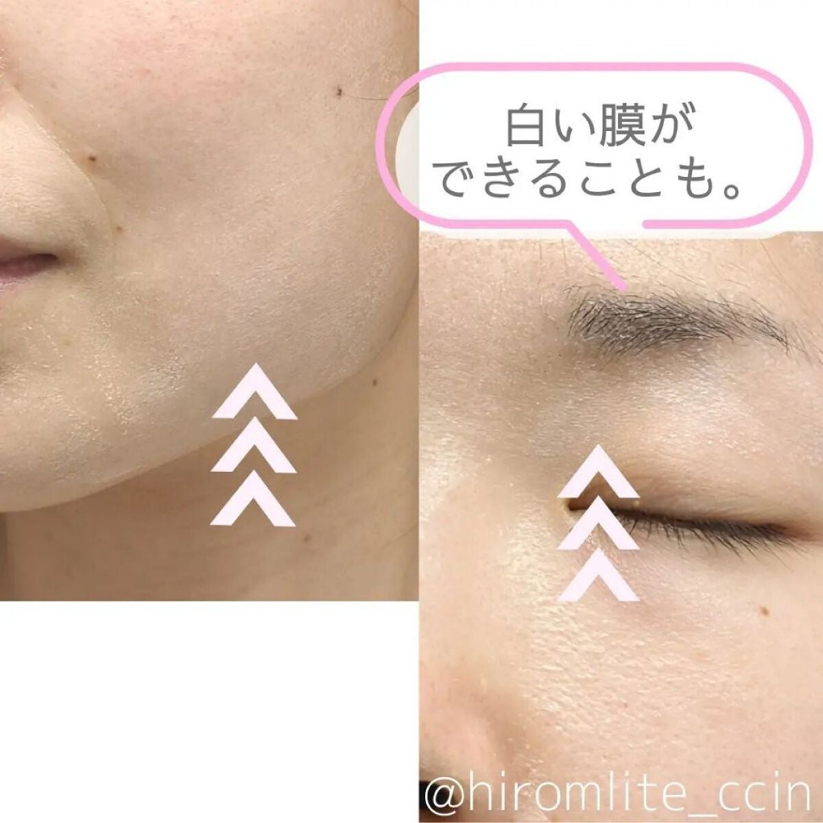 ã²ãã¿ã¡ðææèã³ã¹ã¡ã³ã³ã·ã§ã«ãžã¥ on LIPS ãå§åçä¿è·åâä¿æ¹¿ãžã§ã«ã®ãããªäœ¿çšæã®é«æ¿åºŠãã€ã¢ã·ã³ã¢ãã..ãïŒ6æç®ïŒ