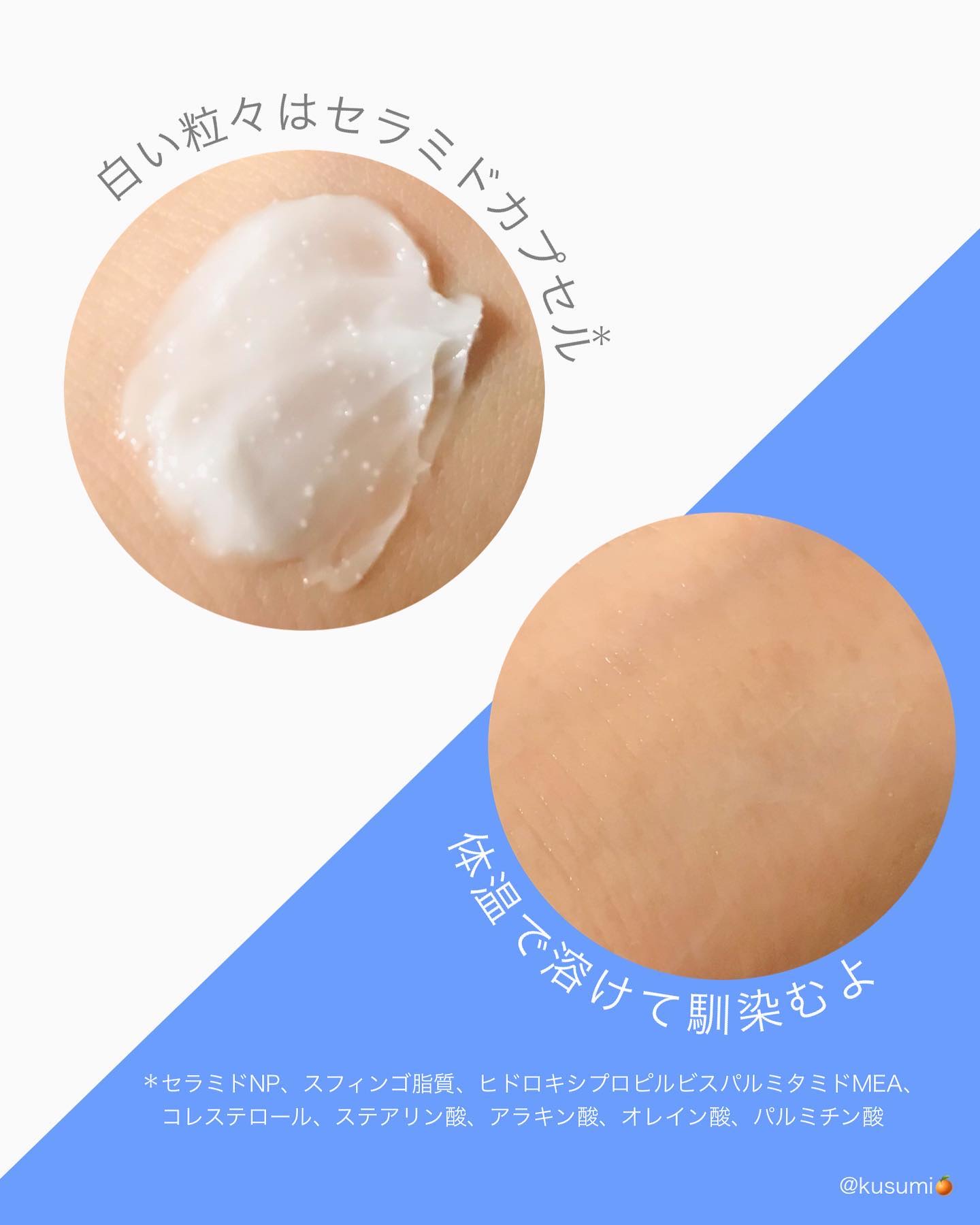 アトバリア365クリーム/AESTURA/フェイスクリームを使ったクチコミ（2枚目）