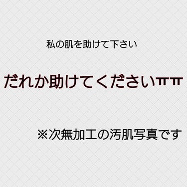 ごろーちゃん。 on LIPS 「だれか助けて下さい…私は昔から敏感肌の激弱肌で紫外線アレルギー..」（1枚目）