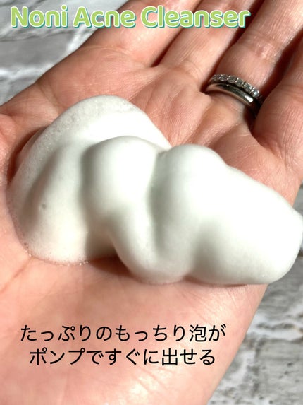 ザリアルノニアクネバブルクレンザー/celimax/泡洗顔を使ったクチコミ(2枚目)