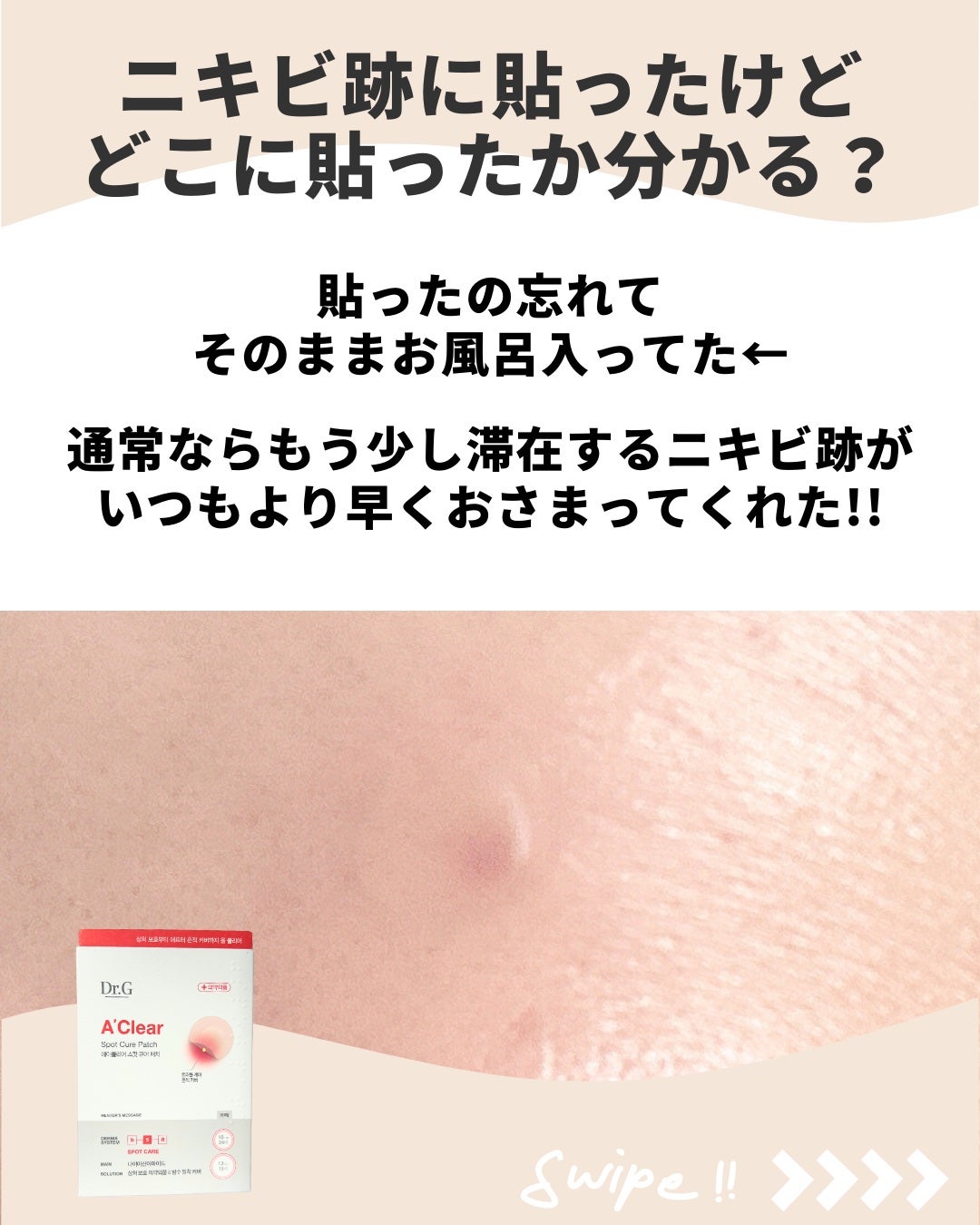 エイクリアスポットキュアパッチ/Dr.G/その他スキンケアを使ったクチコミ(4枚目)