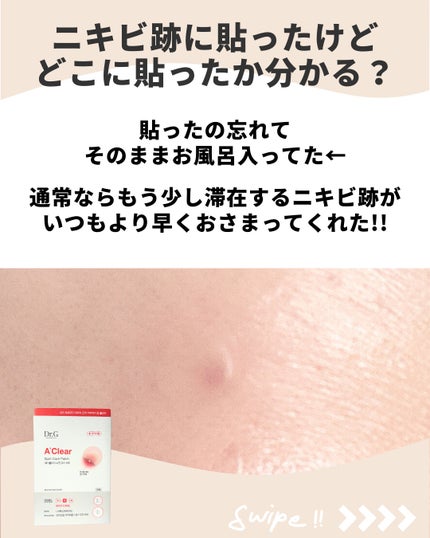 エイクリアスポットキュアパッチ/Dr.G/その他スキンケアを使ったクチコミ(4枚目)