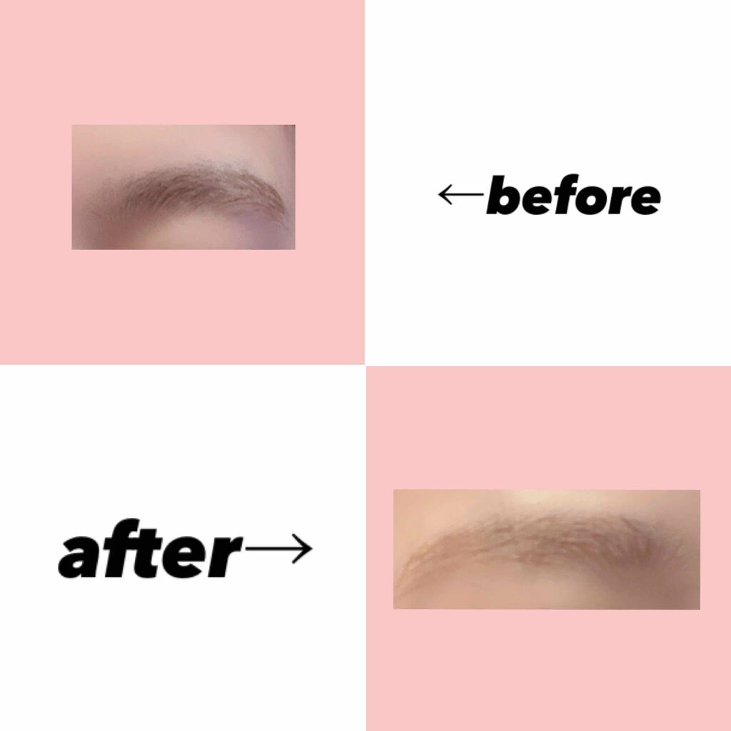 脱色クリーム 敏感肌用/エピラット/ムダ毛ケアを使ったクチコミ（3枚目）