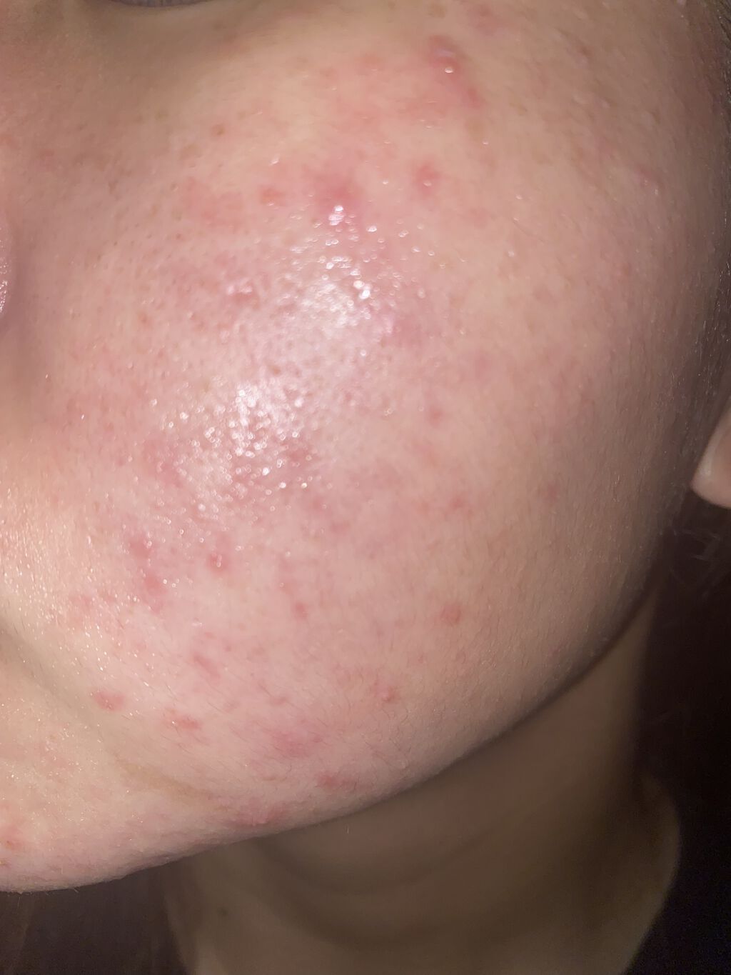 潤浸保湿 化粧水 II しっとり/キュレル/化粧水を使ったクチコミ（1枚目）