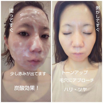 炭酸パック プルリ/ウツクシア/洗い流すパック・マスクを使ったクチコミ(3枚目)