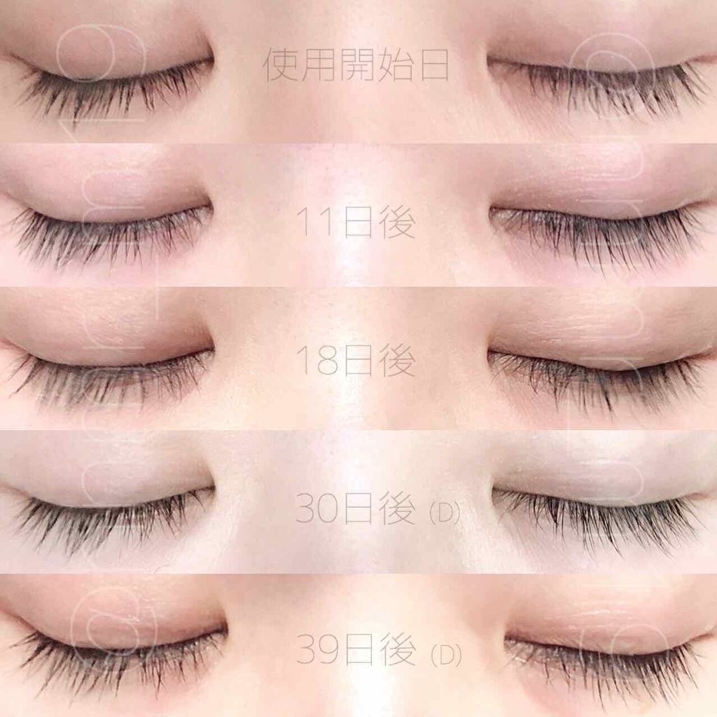 スカルプD ボーテ ピュアフリーアイラッシュセラム/アンファー(スカルプD)/まつげ美容液を使ったクチコミ(2枚目)